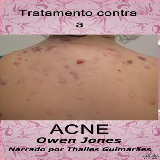 Tratamento contra a acne, Owen Jones