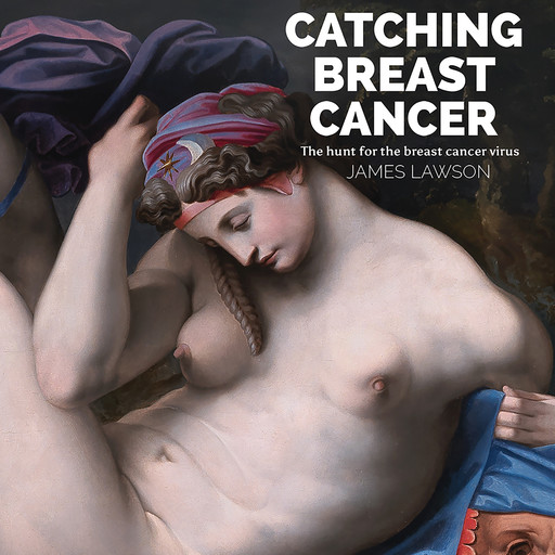 Catching Breast Cancer, James Lawson