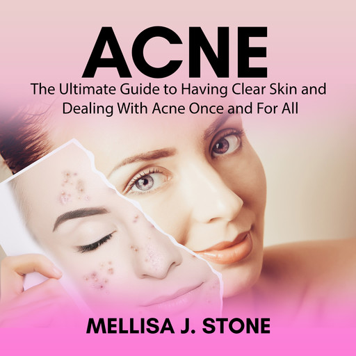 Acne: The Ultimate Guide to Having Clear Skin and Dealing With Acne Once and For All, Mellisa J. Stone