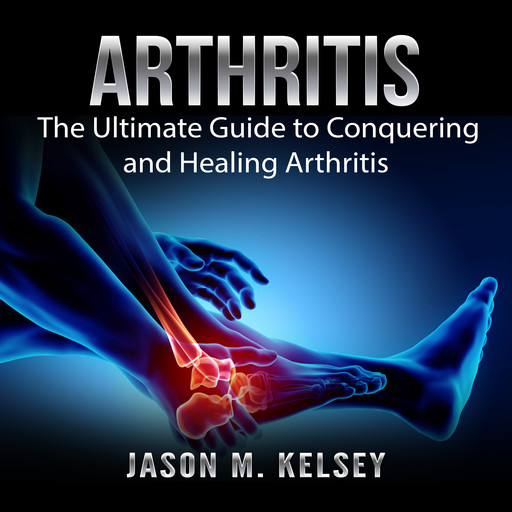 Arthritis: The Ultimate Guide to Conquering and Healing Arthritis, Jason M. Kelsey