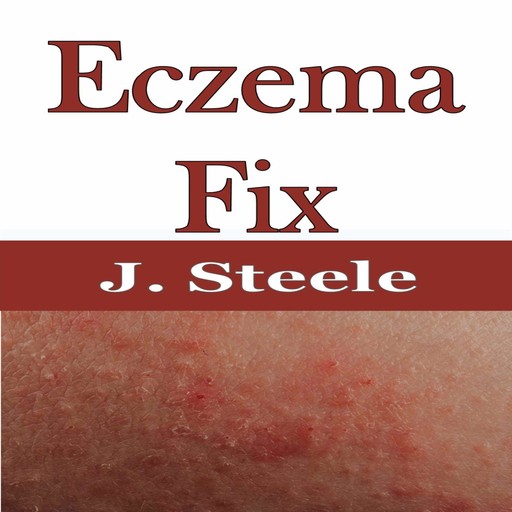 Eczema Fix, J.Steele