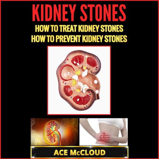 Kidney Stones: How To Treat Kidney Stones: How To Prevent Kidney Stones, Ace McCloud