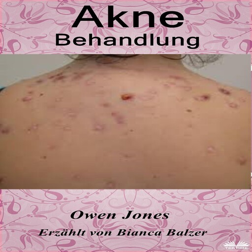 Akne-Behandlung, Owen Jones