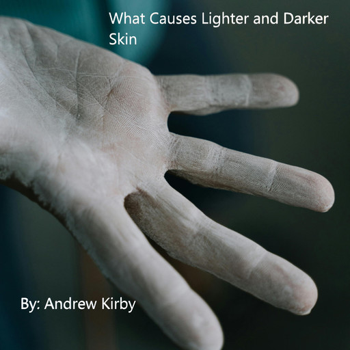 What Causes Lighter and Darker Skin, Andrew Kirby