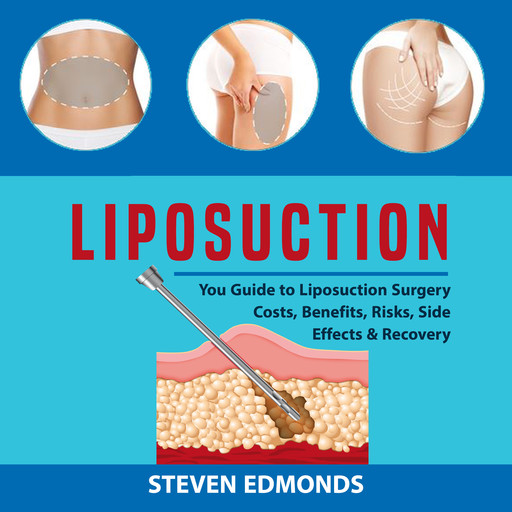 Liposuction: You Guide to Liposuction Surgery Costs, Benefits, Risks, Side Effects & Recovery, Steven Edmonds