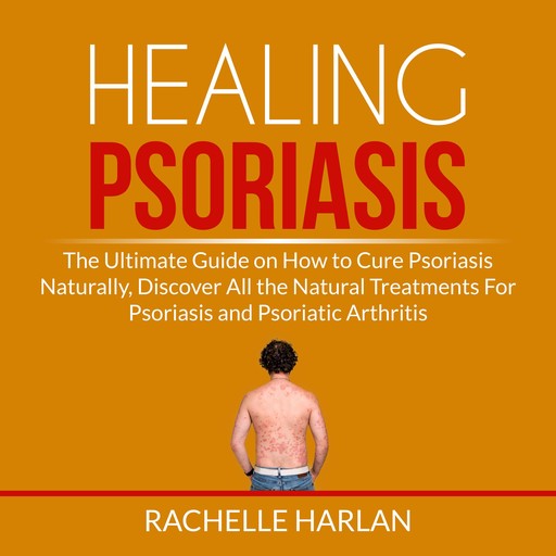 Healing Psoriasis: The Ultimate Guide on How to Cure Psoriasis Naturally, Discover All the Natural Treatments For Psoriasis and Psoriatic Arthritis, Rachelle Harlan
