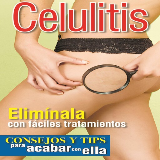 Celulitis, Mina E.