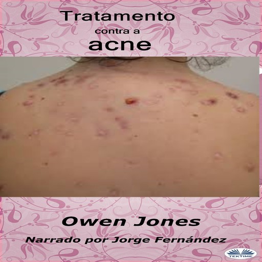 Tratamiento del acné, Owen Jones