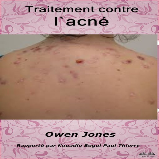Traitement contre l`acné, Owen Jones