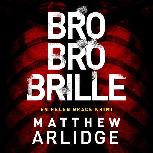 Bro bro brille, Matthew Arlidge