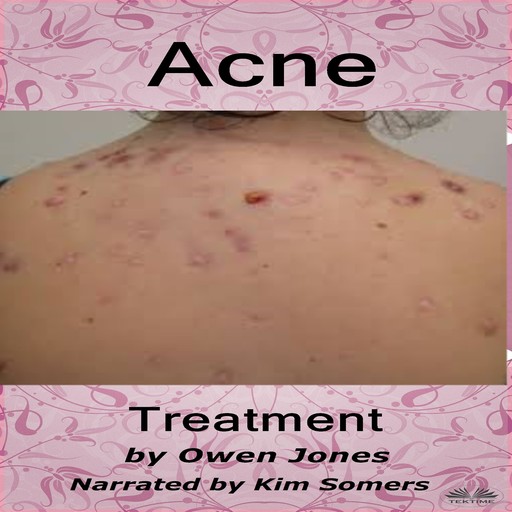 Acne Treatment, Owen Jones