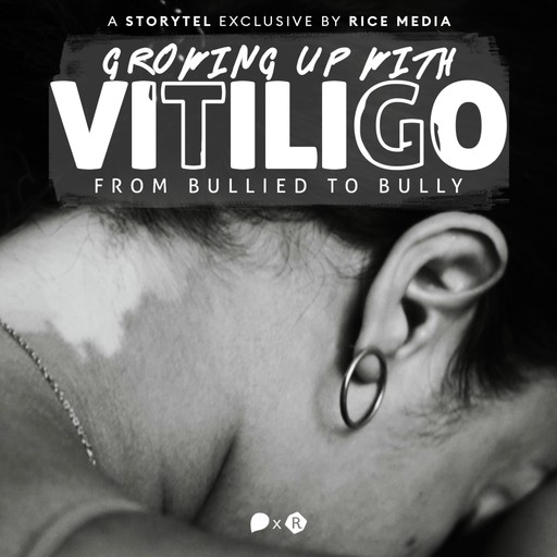 Growing Up With Vitiligo, I Was Bullied—Until I Became A Bully, RICE media