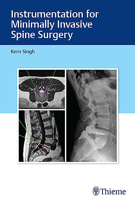 Instrumentation for Minimally Invasive Spine Surgery, Kern Singh