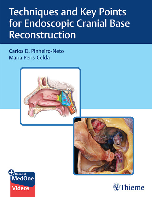 Techniques and Key Points for Endoscopic Cranial Base Reconstruction, Maria Peris-Celda, Carlos D. Pinheiro-Neto