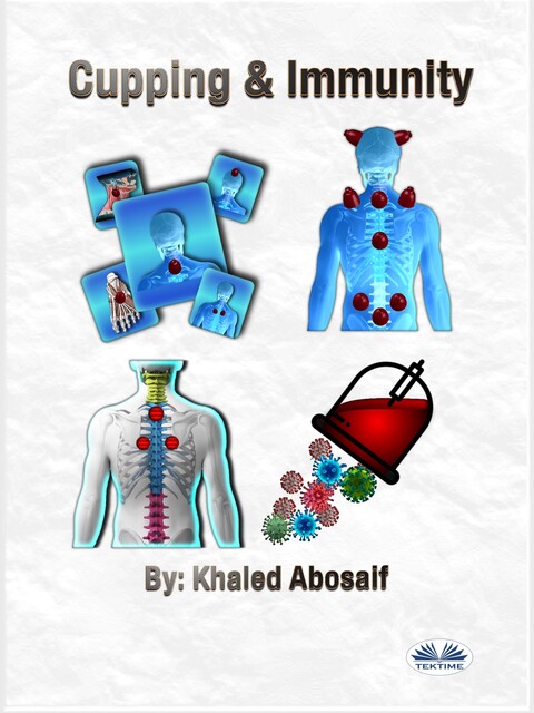 Cupping & Immunity, Khaled Abosaif