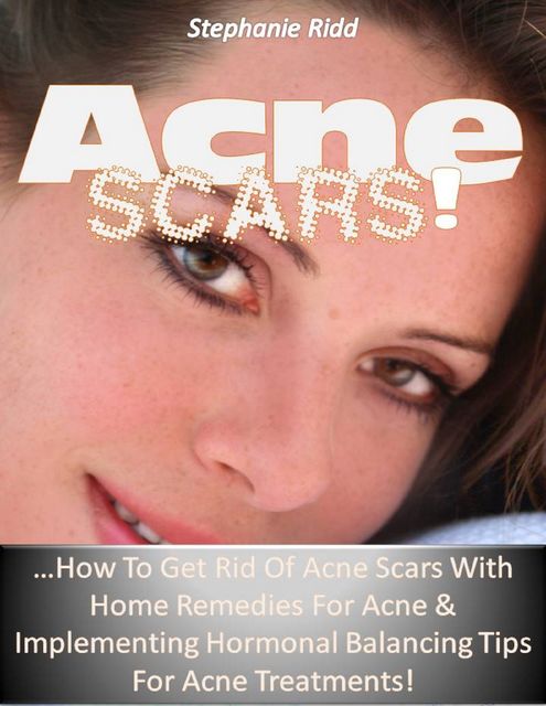Acne Scars! How to Get Rid of Acne Scars With Home Remedies for Acne and Implementing Hormonal Balancing Tips for Acne Treatments!, Stephanie Ridd
