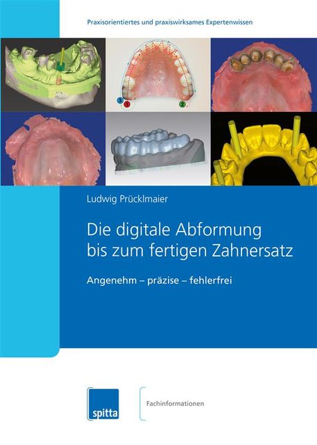 Die digitale Abformung bis zum fertigen Zahnersatz, Ludwig Prücklmaier