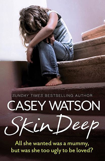 Skin Deep, Casey Watson