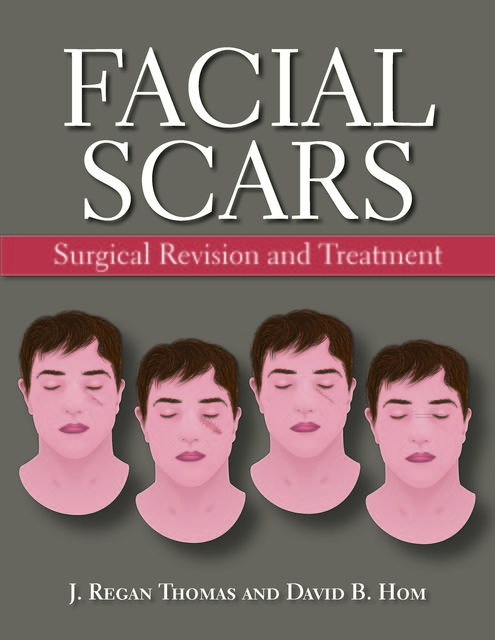 Facial Scars, Thomas J., David B. Hom