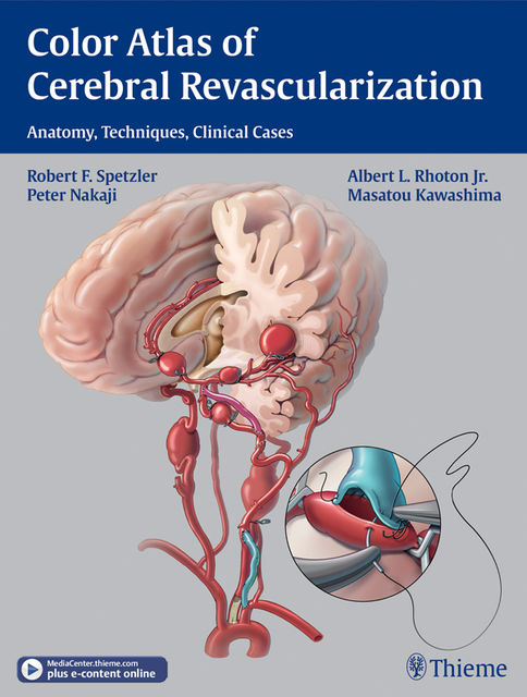 Color Atlas of Cerebral Revascularization, Robert F.Spetzler, Albert L.Rhoton, Peter Nakaji