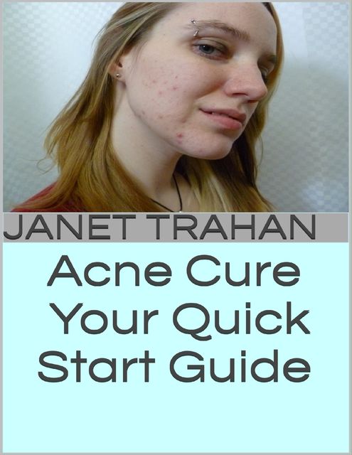 Acne Cure: Your Quick Start Guide, Janet Trahan