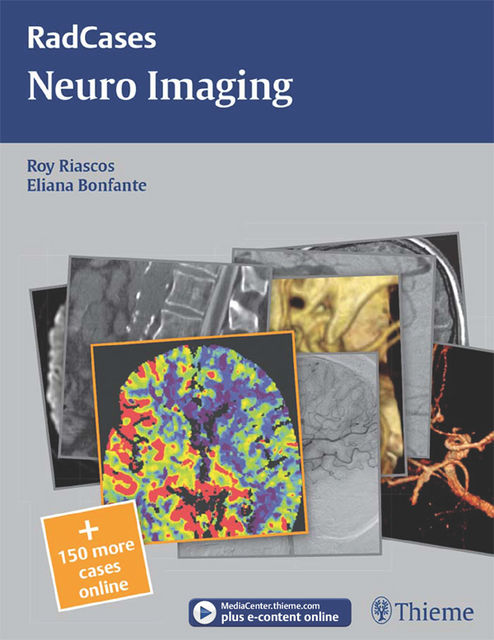 Neuro Imaging, Eliana Bonfante, Roy Riascos