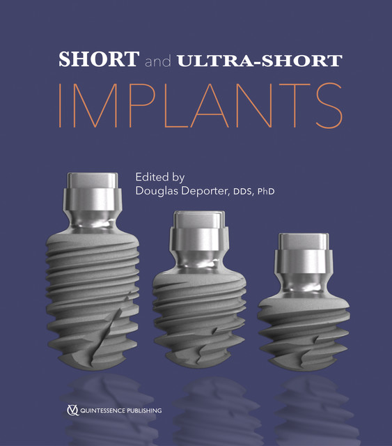 Short and Ultra-Short Implants, Douglas Deporter