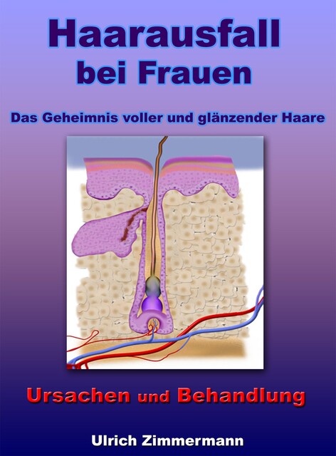 Haarausfall bei Frauen – Ursachen und Behandlung – Das Geheimnis voller und glänzender Haare, Ulrich Zimmermann