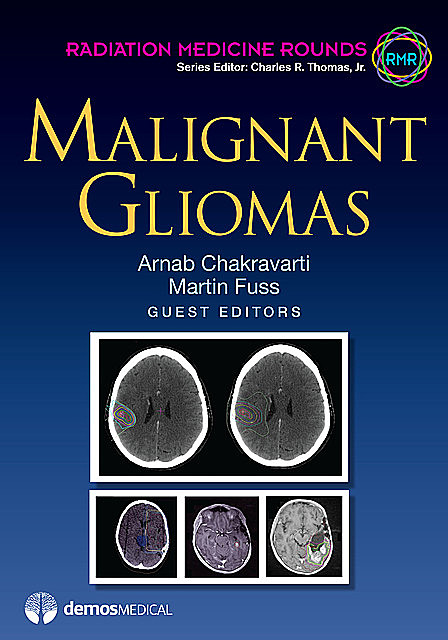 Malignant Gliomas, J.R., Thomas Charles, Arnab Chakravarti, Martin Fuss