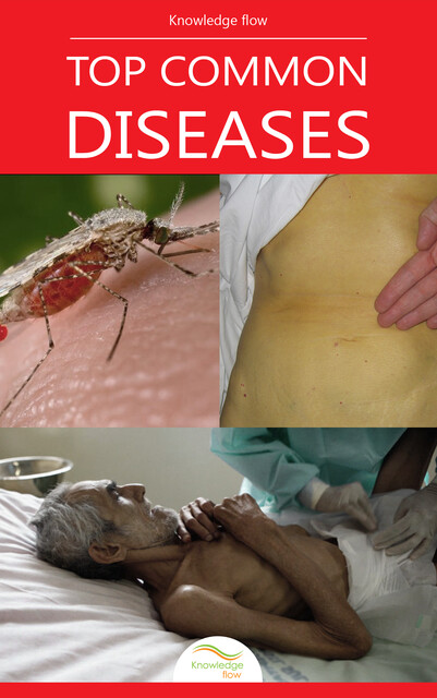Top Common Diseases, Knowledge flow