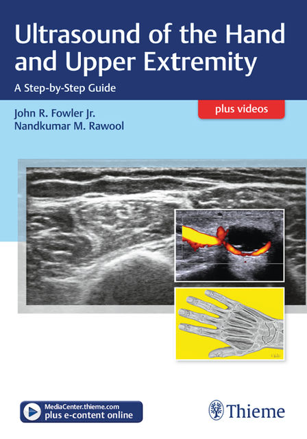Ultrasound of the Hand and Upper Extremity, John Fowler, Nandkumar M. Rawool
