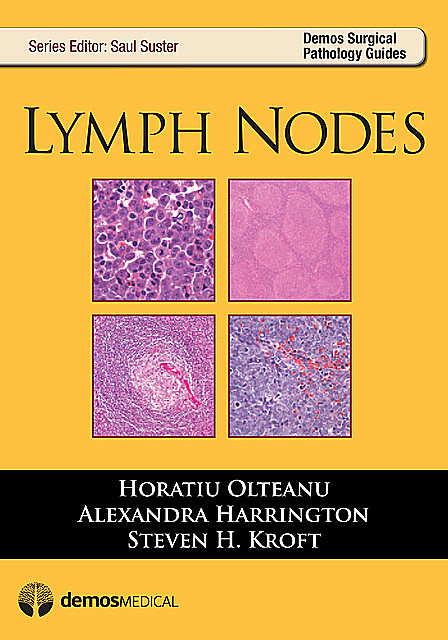 Lymph Nodes, Alexandra Harrington, Horatiu Olteanu, Steven H. Kroft