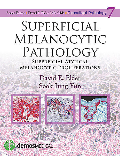 Superficial Melanocytic Pathology, David Elder, ChB, MB, Sook Jung Yun
