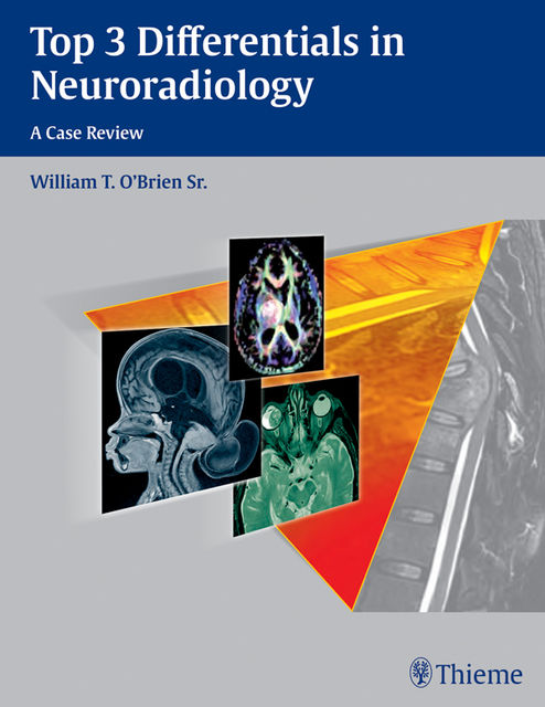 Top 3 Differentials in Neuroradiology, William O'Brien
