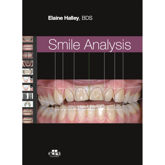 Smile Analysis, Elaine Halley