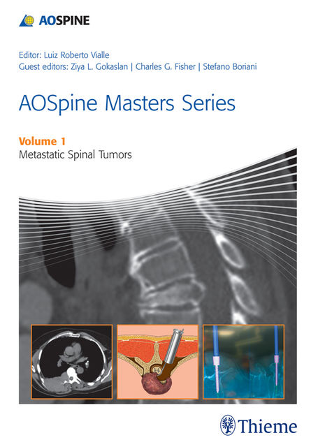 AOSpine Masters Series Volume 1: Metastatic Spinal Tumors, Ziya L.Gokaslan, Luiz Roberto Gomes Vialle, Stefano Boriani