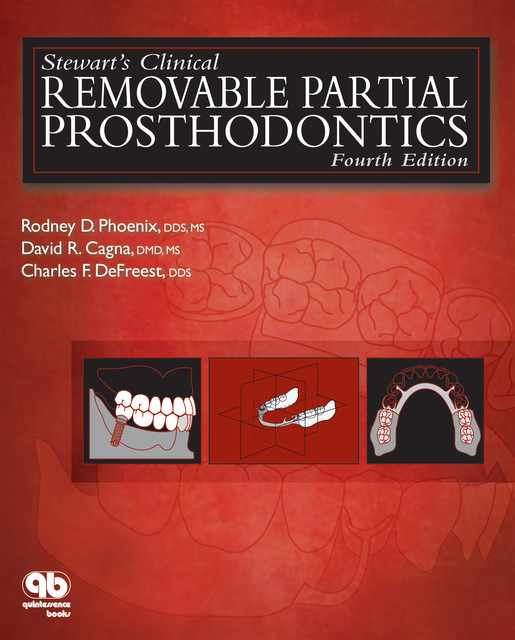 Stewart's Clinical Removable Partial Prosthodontics, Charles F. DeFreest, David R. Cagna, Rodney D. Phoenix