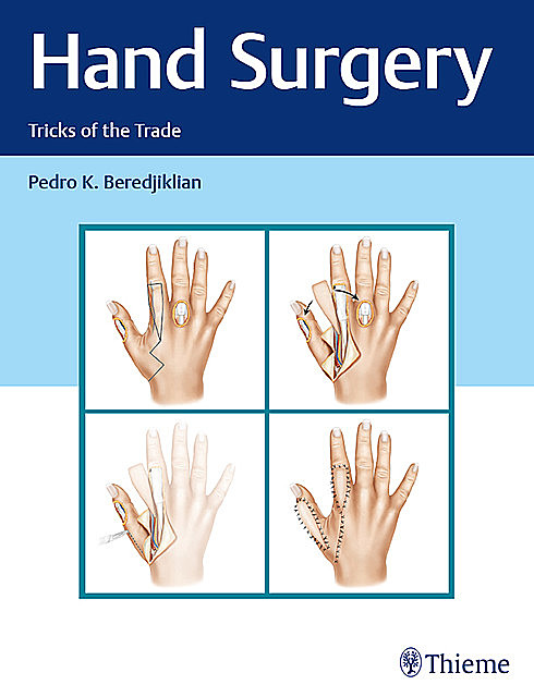 Hand Surgery, Pedro K. Beredjiklian