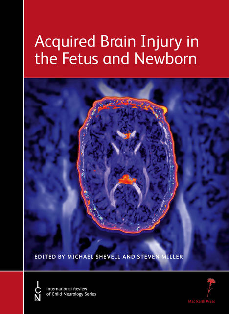 Acquired Brain Injury in the Fetus and Newborn, Michael Shevell, Steven Miller