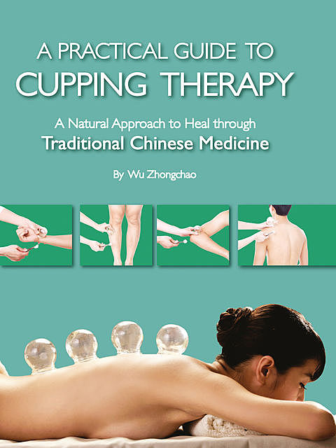 A Practical Guide to Cupping Therapy, Wu Zhongchao