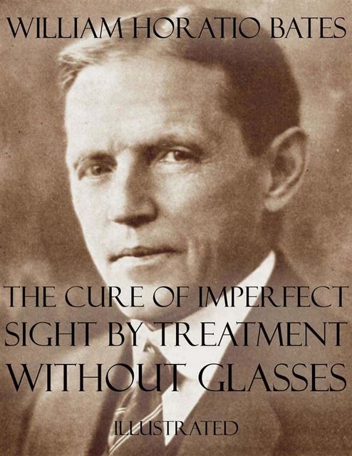 The Cure of Imperfect Sight by Treatment Without Glasses, William Bates
