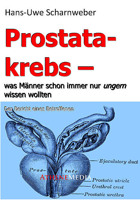 Prostatakrebs, Hans-Uwe Scharnweber