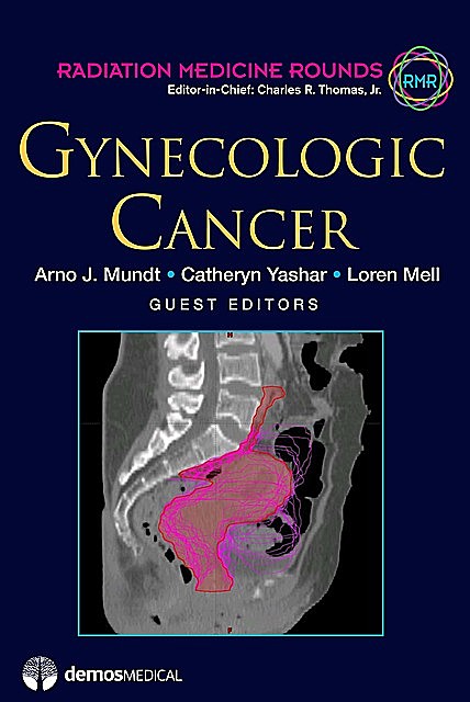 Gynecologic Cancer, J.R., Thomas Charles