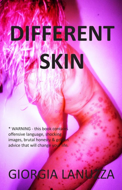 Different Skin, Giorgia Lanuzza