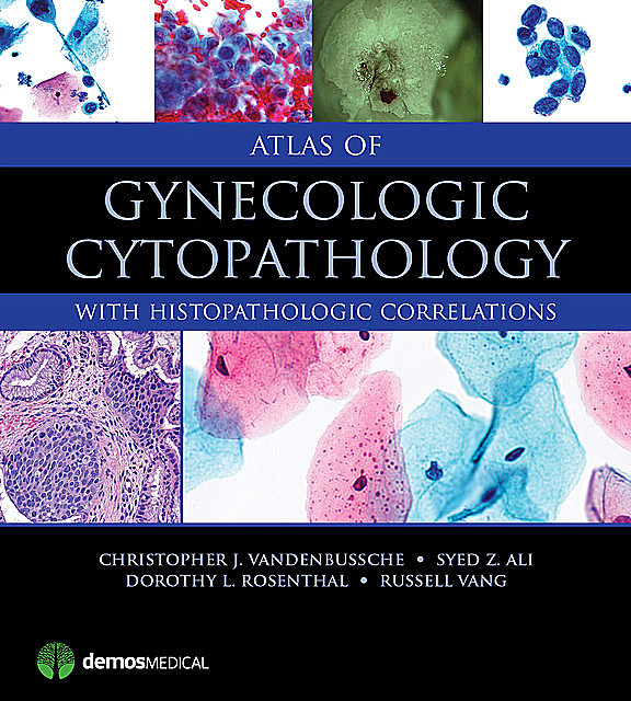 Atlas of Gynecologic Cytopathology, Syed Ali, FRCPath, FIAC, Christopher J. VandenBussche, Dorothy L. Rosenthal, Russell Vang
