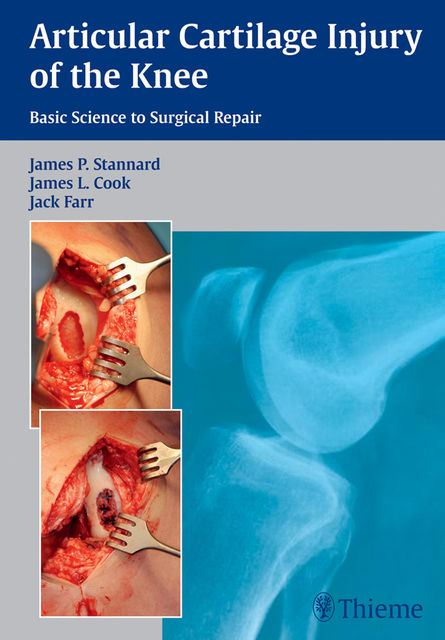 Articular Cartilage Injury of the Knee: Basic Science to Surgical Repair, James Cook, James P.Stannard, Jack Farr