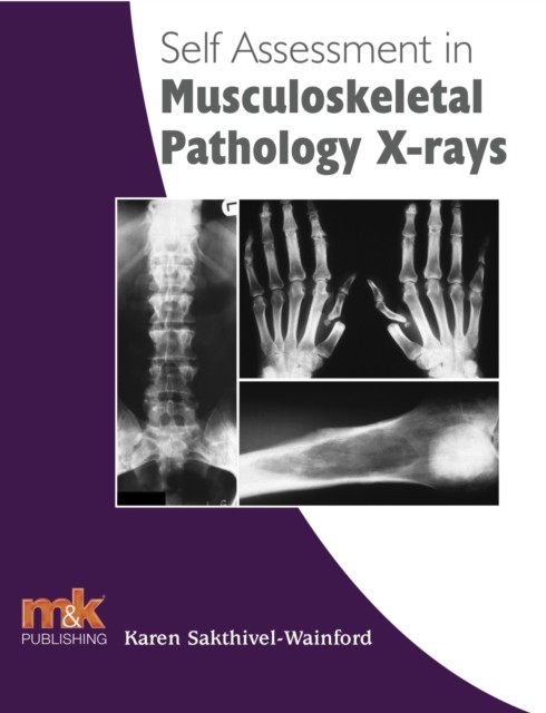 Self Assessment in Musculoskeletal Pathology X-rays, Karen Sakthivel Wainford