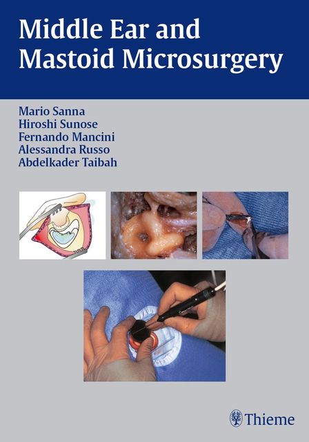 Middle Ear and Mastoid Microsurgery, Mario Sanna, Hiroshi Sunose