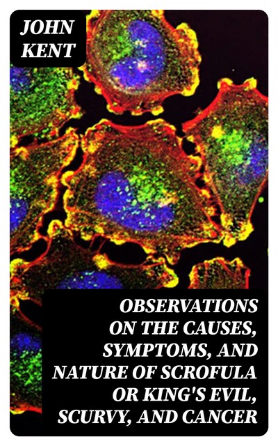 Observations on the Causes, Symptoms, and Nature of Scrofula or King's Evil, Scurvy, and Cancer, John Kent