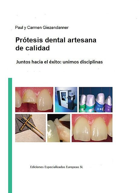 Prótesis dental artesanal de calidad, Carmen Giezendanner, Paul Giezendanner